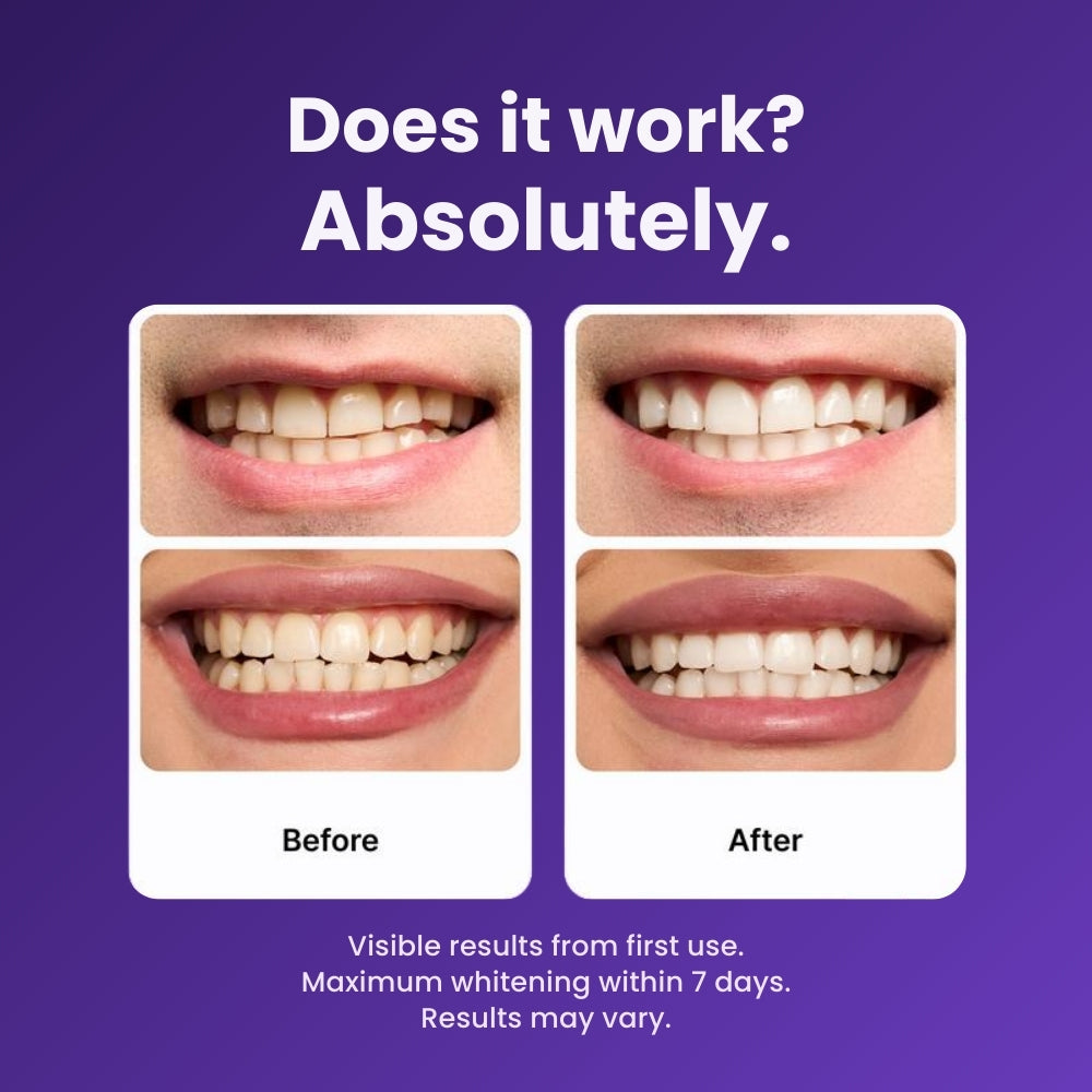 Purple Teeth Whitening Strips